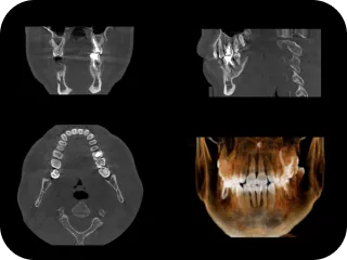 提携のインプラント専門医による手術が可能