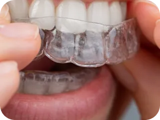 目立たないマウスピース矯正