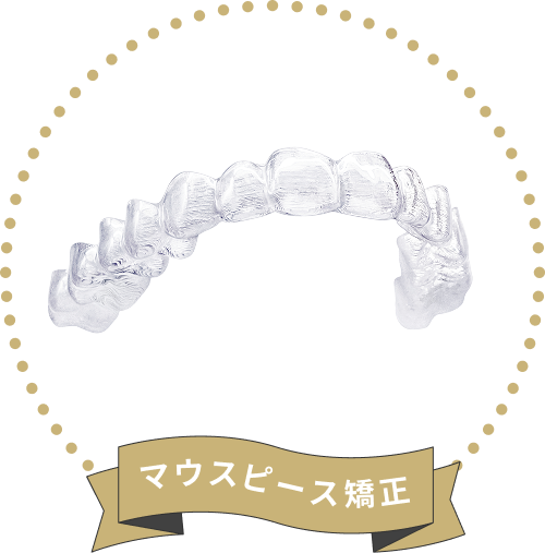 マウスピース矯正